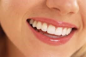 Professional Teeth Bleaching 